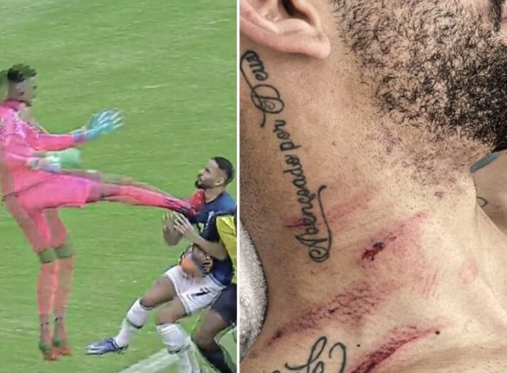 Куња ја покажа раната од карате ударот на еквадорскиот голман