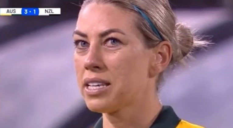 (ВИДЕО) Смешна реакција на фудбалерката на Сити кога виде дека и е скршен носот